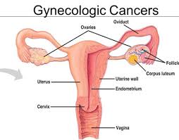 Gynaecological cancer in Low Income Countries